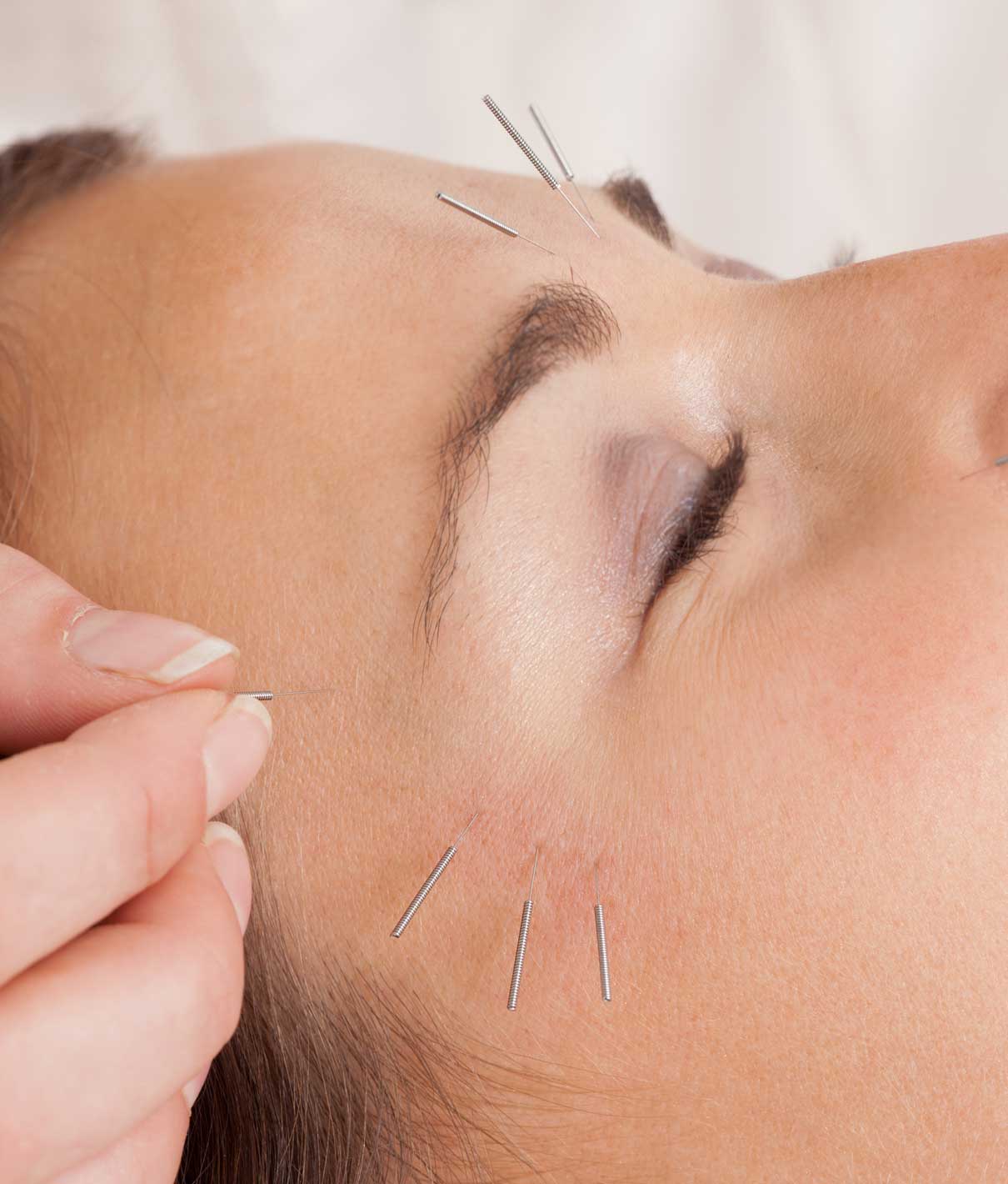 Acupuncture et facial - Lifting